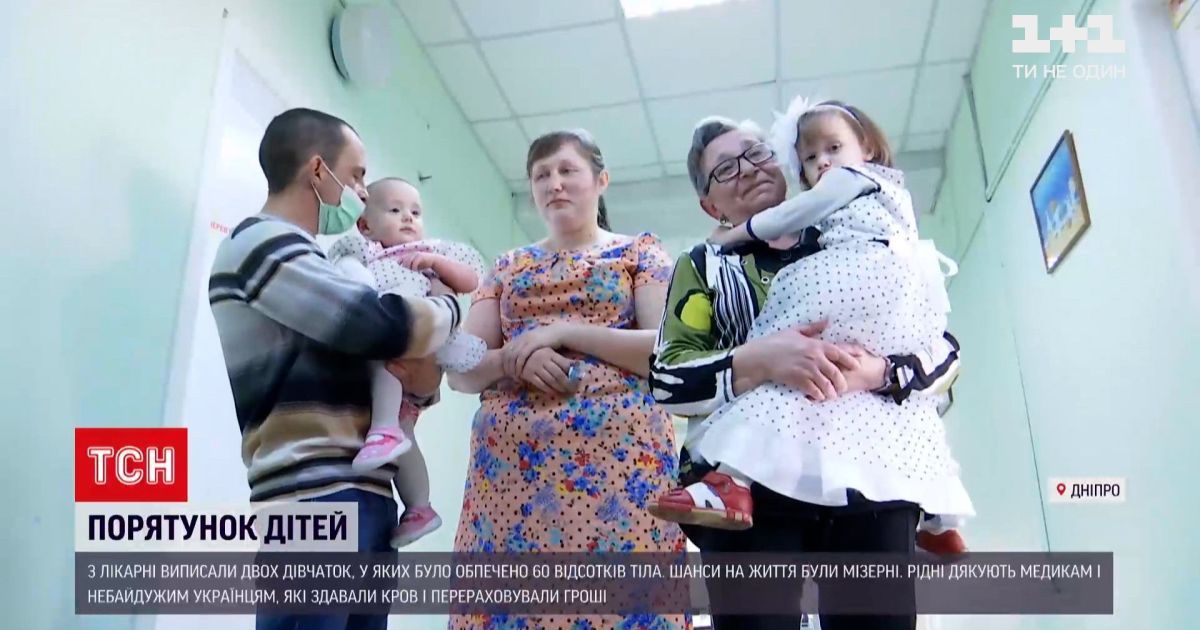 У Дніпрі з лікарні виписали двох дівчаток, які зазнали 60% опіків тіла: подробиці