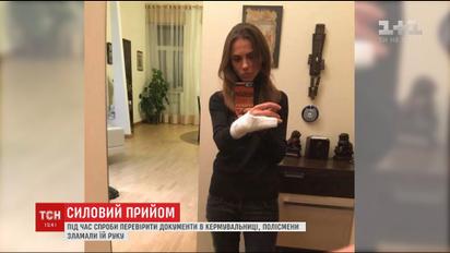 Полицейские сломали руку владелице авто при попытке проверить ее документы