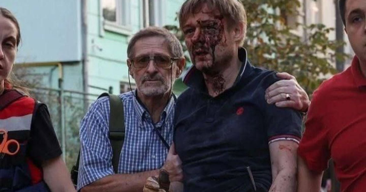 Чоловік Ярослав після ракетної атаки по Львову / Фото із соцмереж