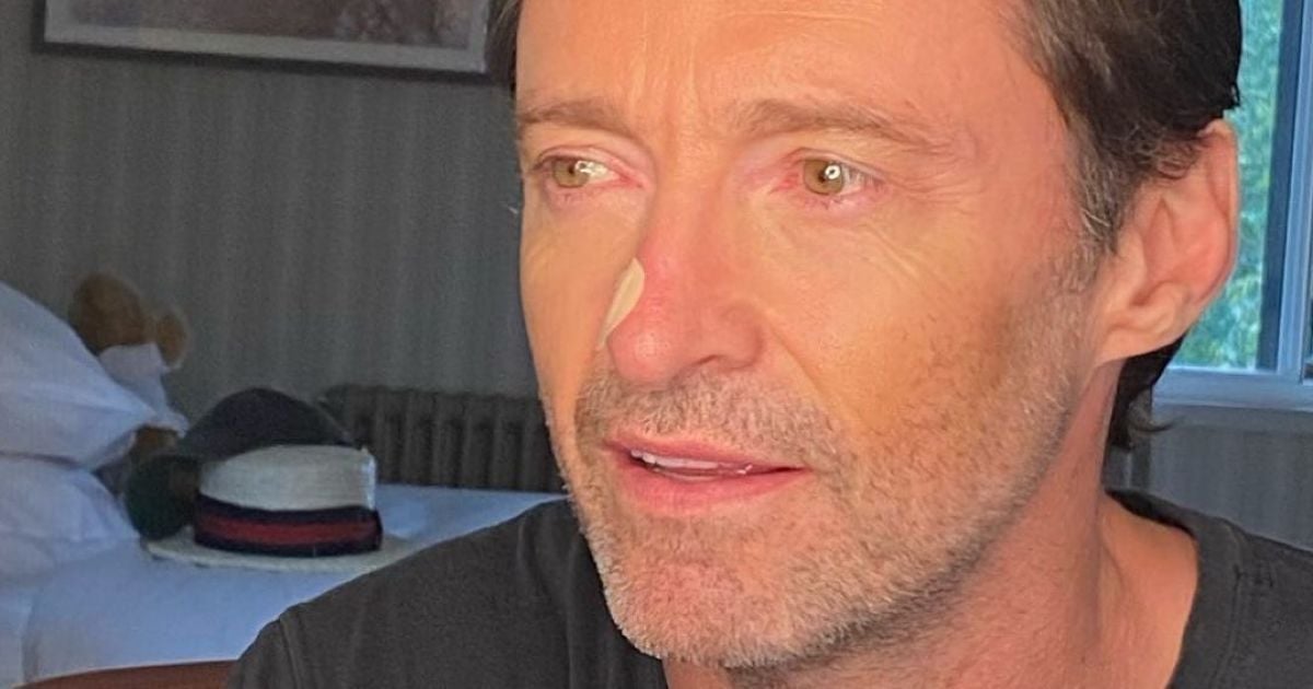 Новости шоу-бизнеса: В Хью Джекмана заподозрили рецидив рака кожи — видео — Гламур — tsn.ua - Vimarsana News