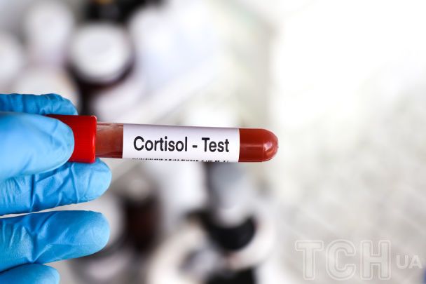 Гормон стресу кортизол: норма, обстеження, симптоми підвищеного та зниженого кортизолу / © Credits