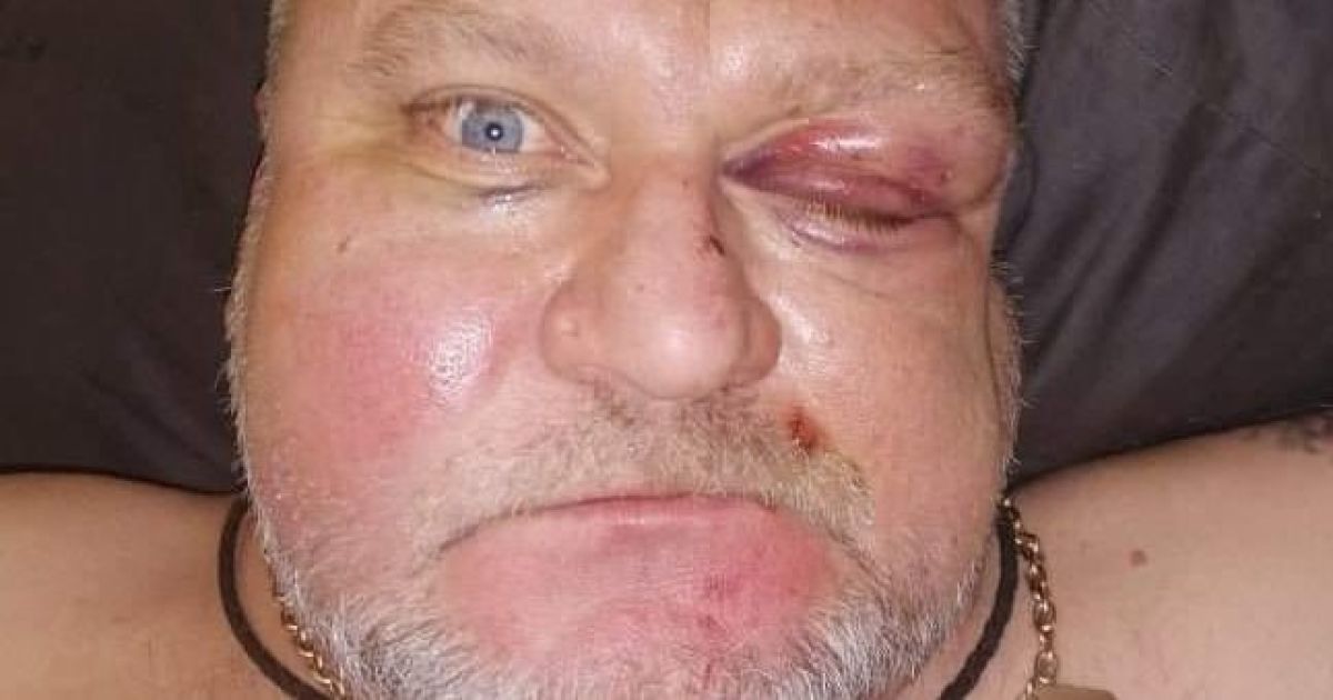 В Херсоне жестоко избили депутата из-за замечаний на улице
