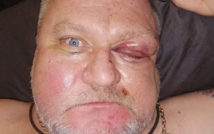 В Херсоне жестоко избили депутата из-за замечаний на улице