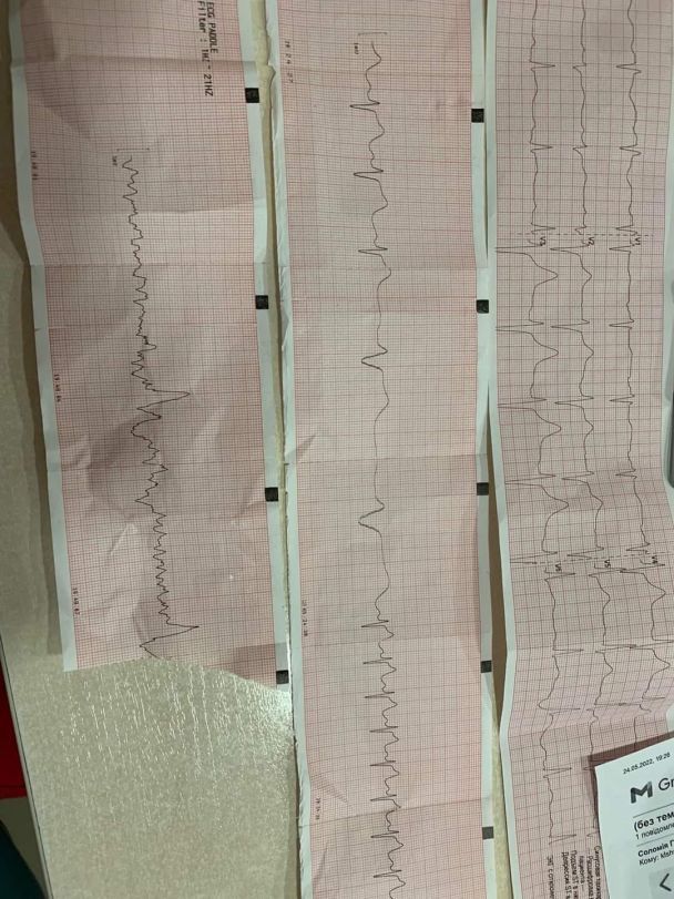 Чоловіка вдалося реанімувати, фото / Львівського обласного центру екстреної медичної допомоги та медицини катастроф