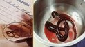 Почечный червь Dioctophyma renale