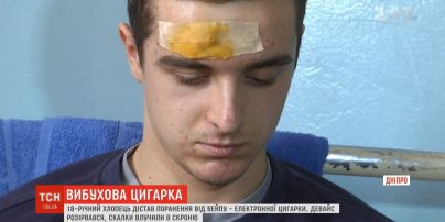Електронна сигарета вибухнула в руках 18-річного хлопця