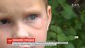 Небезпечні іграшки: як убезпечити дітей від вибухових пристроїв
