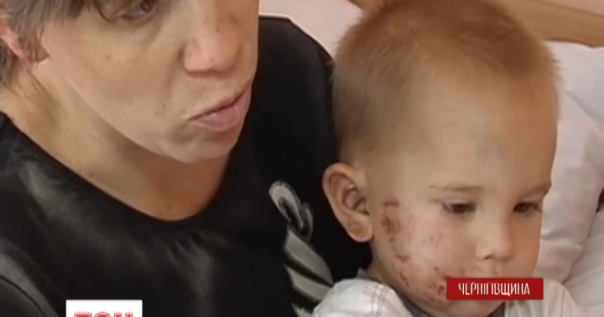 Мальчика чудом удалось спасти
