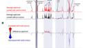 Precision Medicine and Imaging