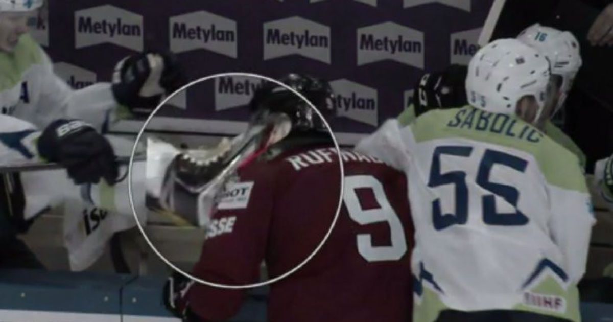 Словенский хоккеист едва не порезал горло сопернику лезвием конька на чемпионате мира