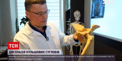 Новости Украины: почему важно делать УЗИ тазобедренных суставов в первые 6 недель жизни