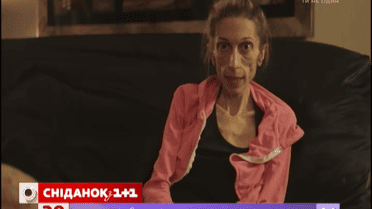 Чаще всего анорексией болеют подростки