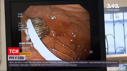 Лікарям столичного "Охматдиту" доводиться втретє за рік витягати зубну щітку зі стравоходу дитини
