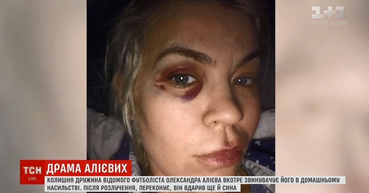 "Зламав ліжко об мою голову": колишня дружина футбольної зірки Алієва заявила про нове побиття