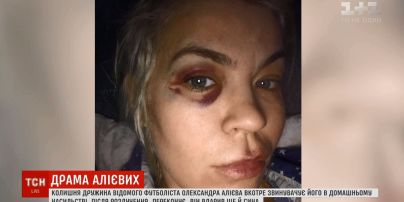 "Зламав ліжко об мою голову": колишня дружина футбольної зірки Алієва заявила про нове побиття