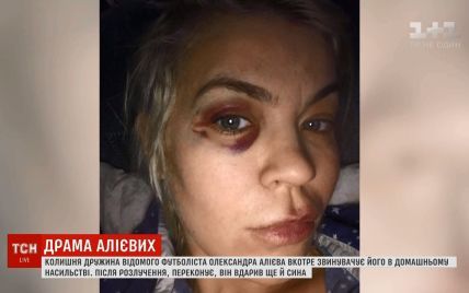 "Зламав ліжко об мою голову": колишня дружина футбольної зірки Алієва заявила про нове побиття