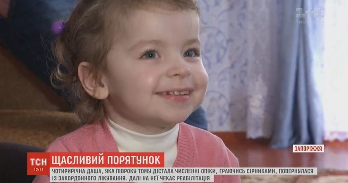4-річна Даша, яку рятували мільйони українців після опіків, повернулась з лікування