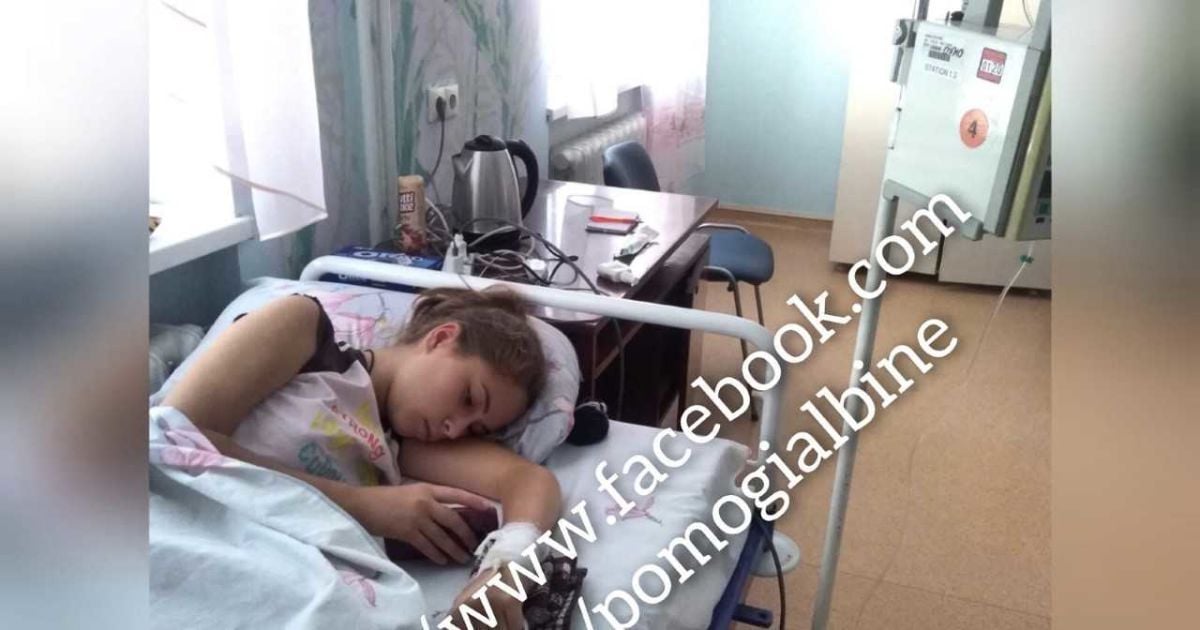 Альбінка через хворобу втратила легеню, тепер під загрозою - життя