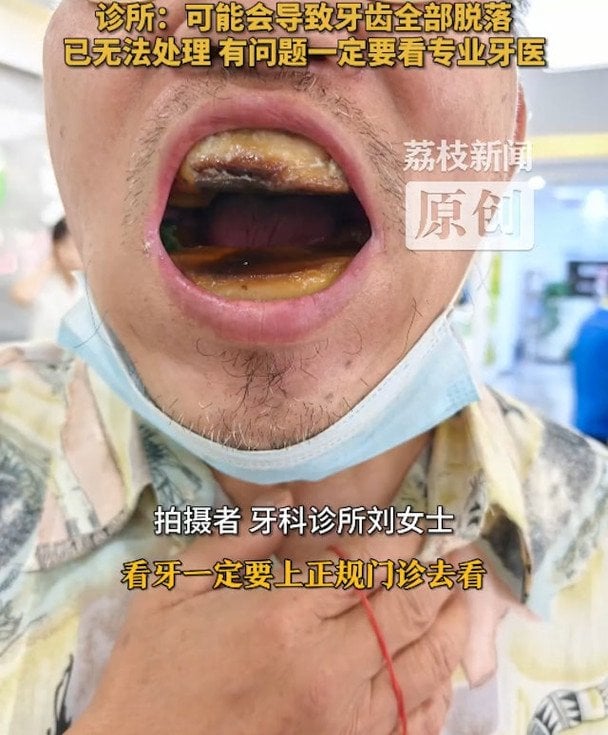 Зуби пенсіонера / © Weibo
