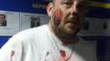 Активісти заявили про побиття поліцією добровольців АТО у Києві