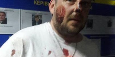 Активисты заявили об избиении полицией добровольцев АТО в Киеве