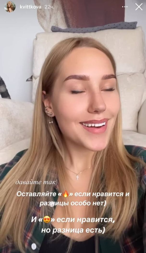 Даша Квиткова после пластической операции / © instagram.com/kvittkova
