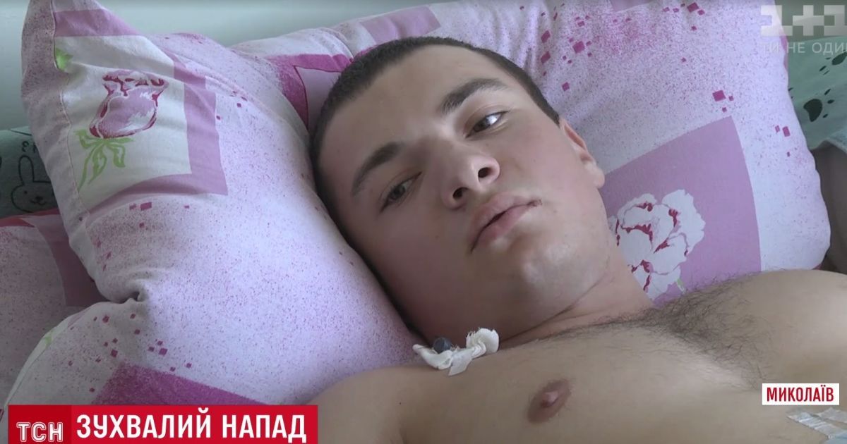 У Миколаєві грабіжники завдали чемпіону з пауерліфтингу сім ножових поранень