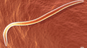 Schistosoma mansoni