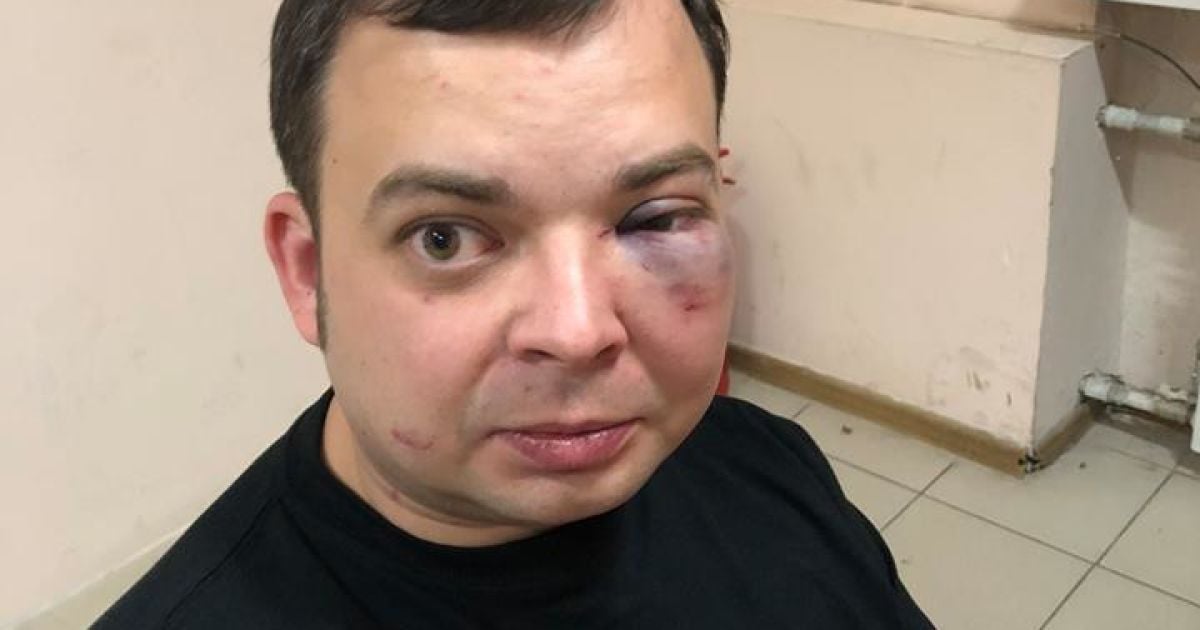 Син Шуфрича побитий_2 / © Facebook/Пресс-служба Нестора Шуфрича