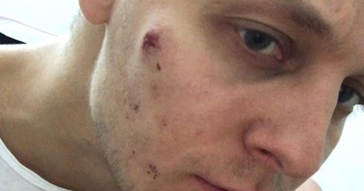 Син Шуфрича побитий_3 / © Facebook/Пресс-служба Нестора Шуфрича