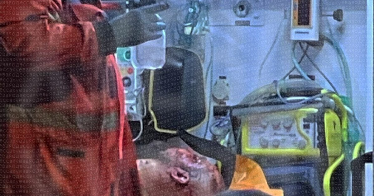 Постраждалий від вибуху в Одесі