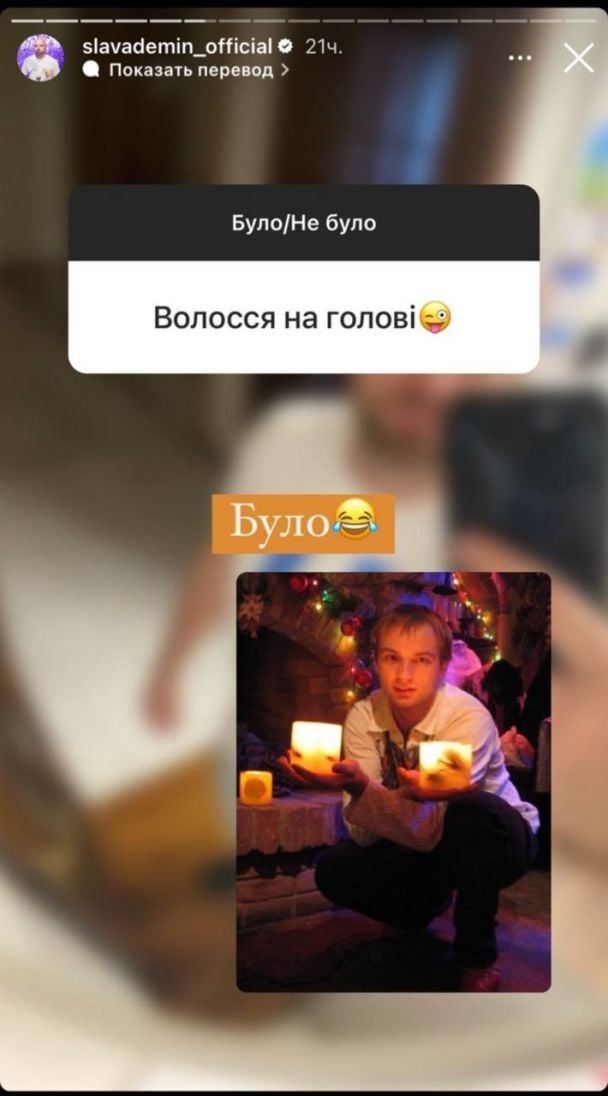 Слава Дьомін з волоссям / © instagram.com/slavademin_official
