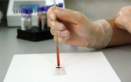 Як група крові впливає на зараження коронавірусом: вчені назвали найбільш чутливі