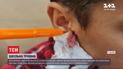 Попал на крючок: школьник получил необычную травму на перемене