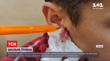 Потрапив на гачок: школяр дістав незвичну травму на перерві