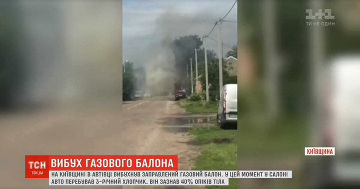 На Киевщине в автомобиле взорвался газовый баллон: пострадал 3-летний ребенок