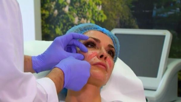 Сумская смело переносит болезненные &laquo;уколы красоты&raquo; / © Светская жизнь