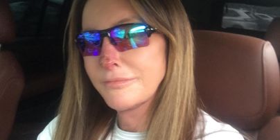 Что случилось с Кейтлин Дженнер: трансгендер показала фото с раной на лице