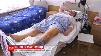 60-летняя женщина перенесла несколько операций после взрыва в маршрутке