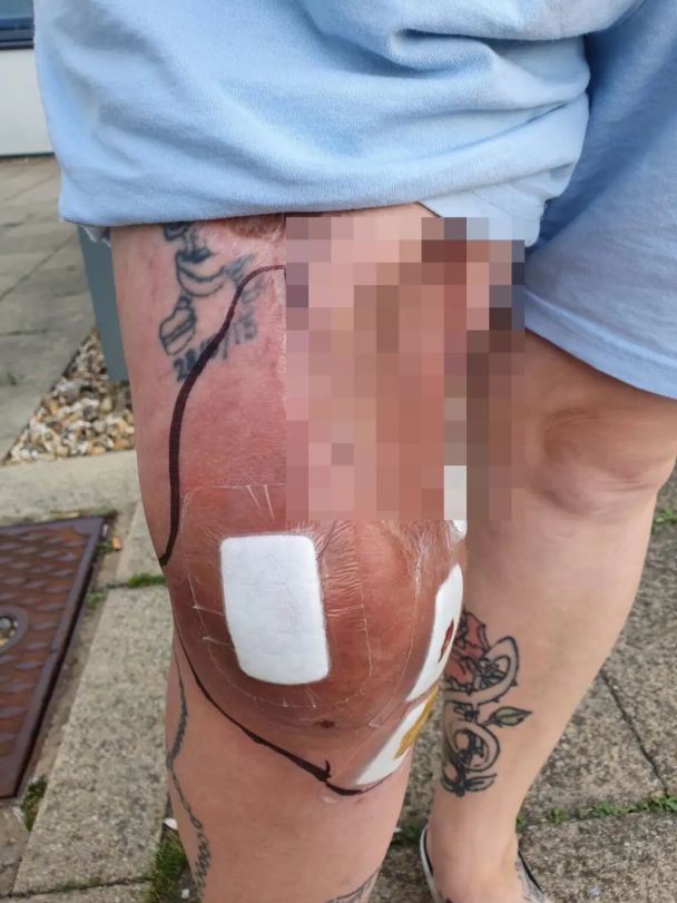 Мішель Мілтон / © SWNS