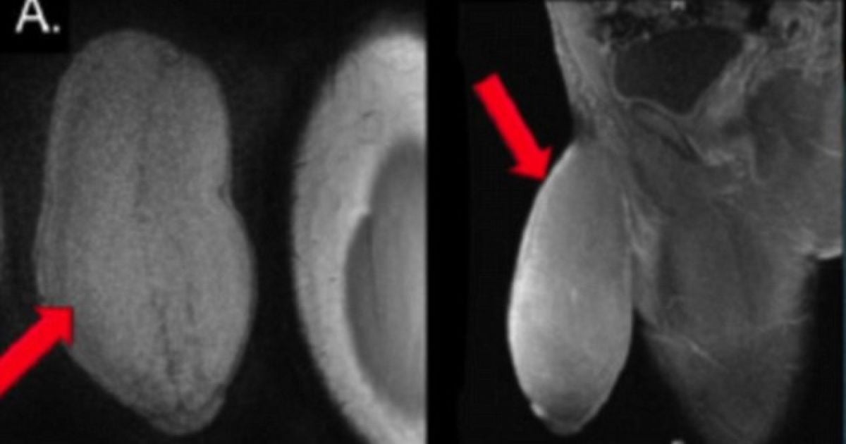 Бөксесі бар секс порно