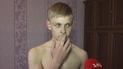 На Ровенщине мужчина кулаками избил 12-летнего мальчика, потому что решил, что тот обидел его сына