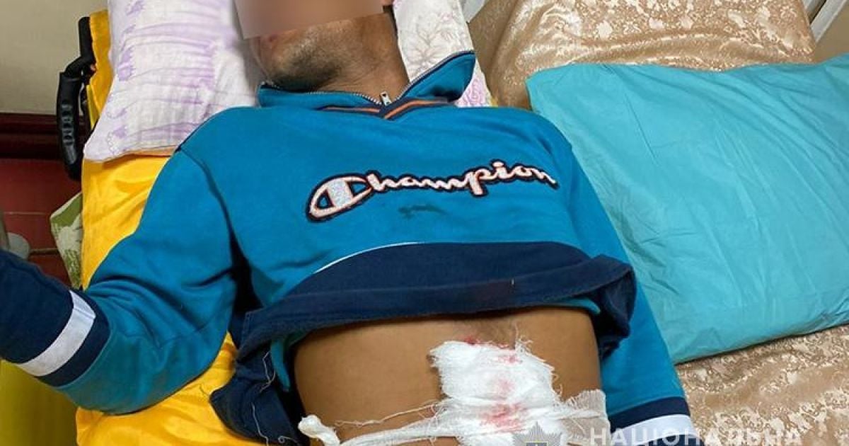 Йшов 2 км, стікаючи кров’ю: у Тернопільській області через їжу підрізали 20-річного хлопця