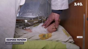 Чудо от медиков: бойца готовили к ампутации, но сделали невозможное