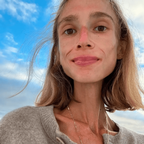 Померла 27-річна вегетаріанка, котра їла лише фрукти: скільки вона важила
