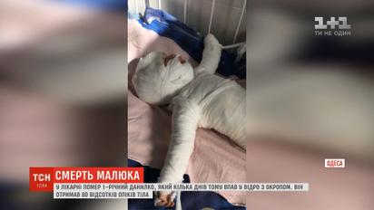 В одеській лікарні помер маленький Данилко, який впав у відро з окропом