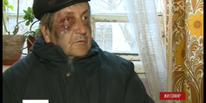 Грабителей, которые пытали пенсионеров, задержали в Житомире