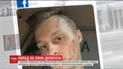 Группа неизвестных избила старшего сына Нестора Шуфрича