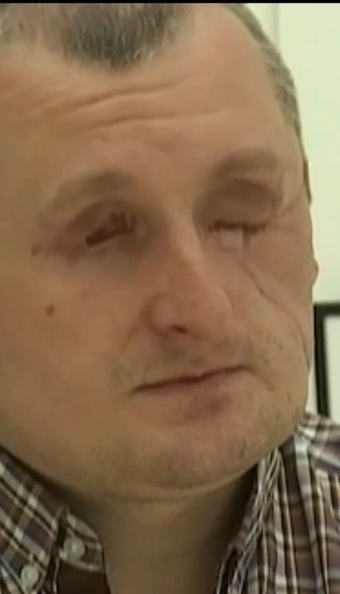 Важкопоранений боєць АТО Олександр Дарморос прилетів до України з лікування у США