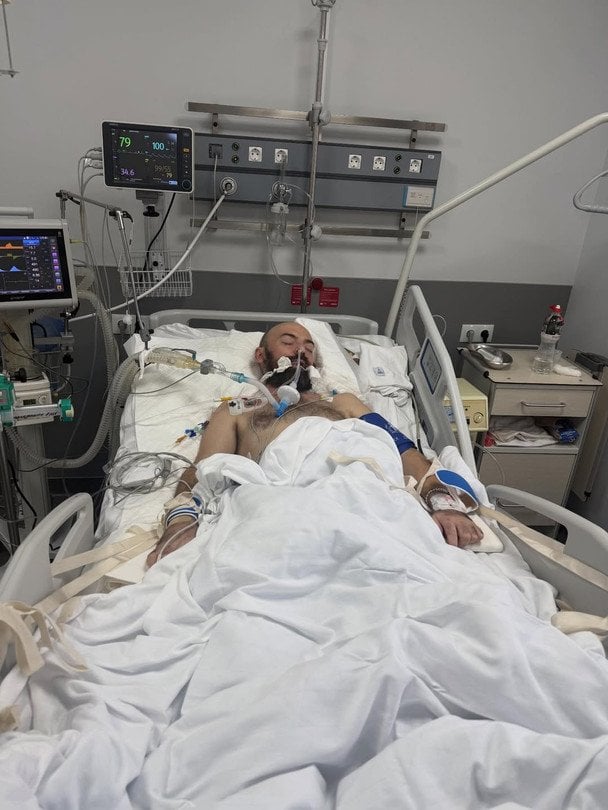 ADAM у комі / © instagram.com/adamukraine